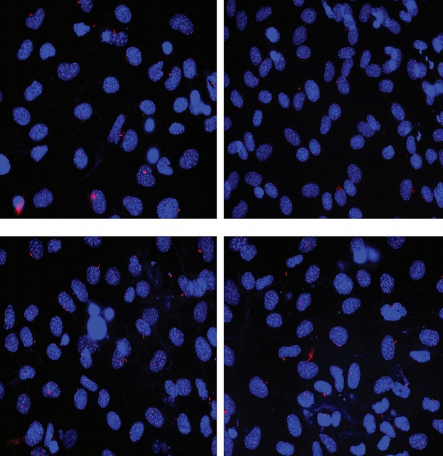 cellule mesenchimali