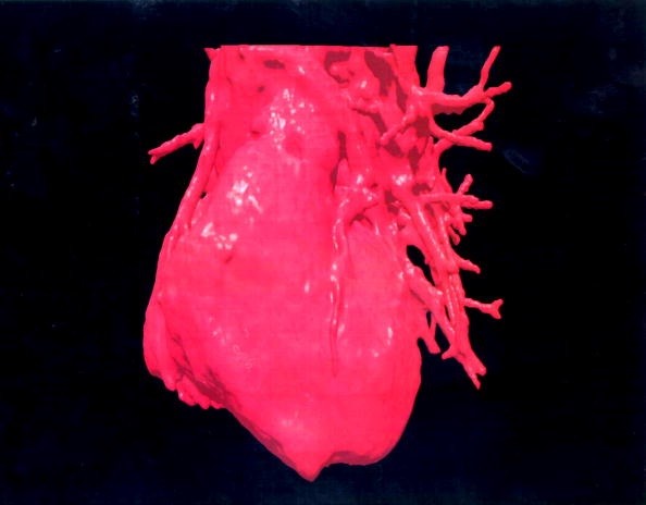 Cuore stampato in 3D