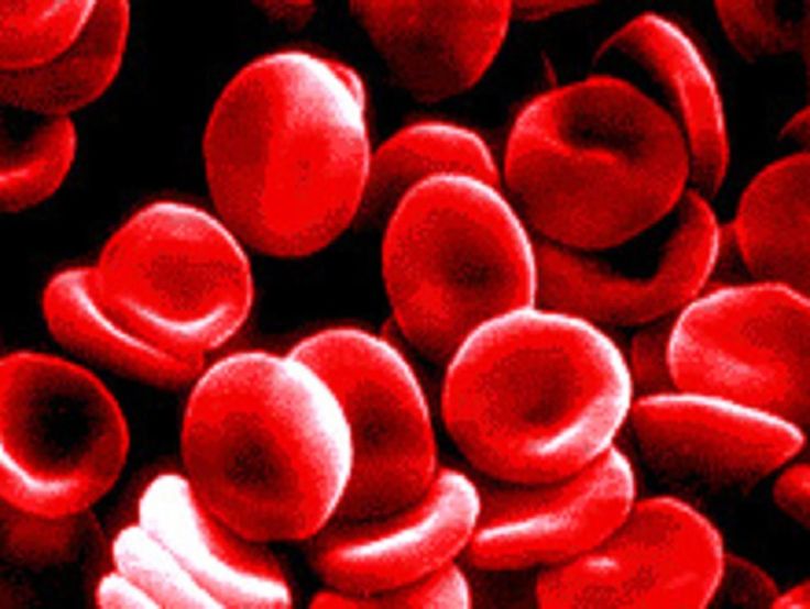 anemia mediterranea e malaria