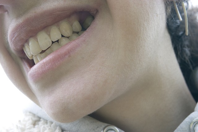 Denti sensibili al caldo e al freddo