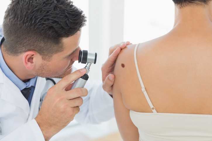 melanoma diagnosi terapia