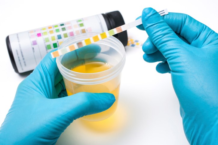 Combur test delle urine per i neonati