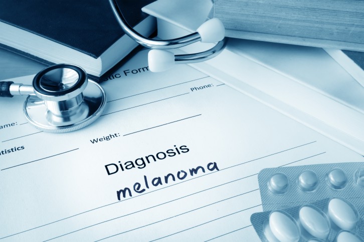 melanoma diagnosi terapia