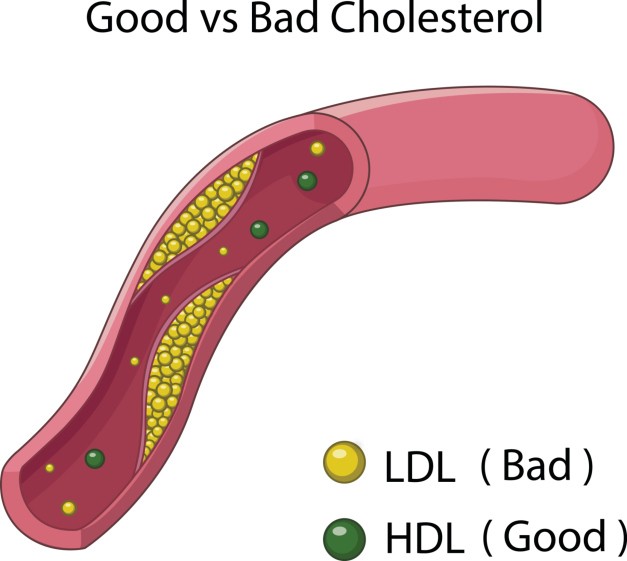 colesterolo hdl fa male