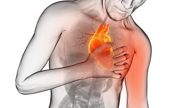 infarto diagnosi test