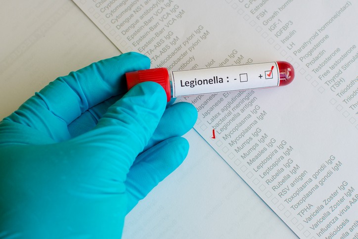 legionella