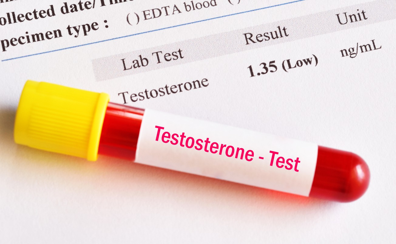 basso livello di testosterone