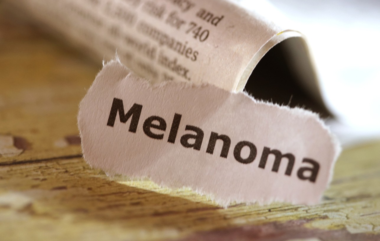 Melanoma in Italia