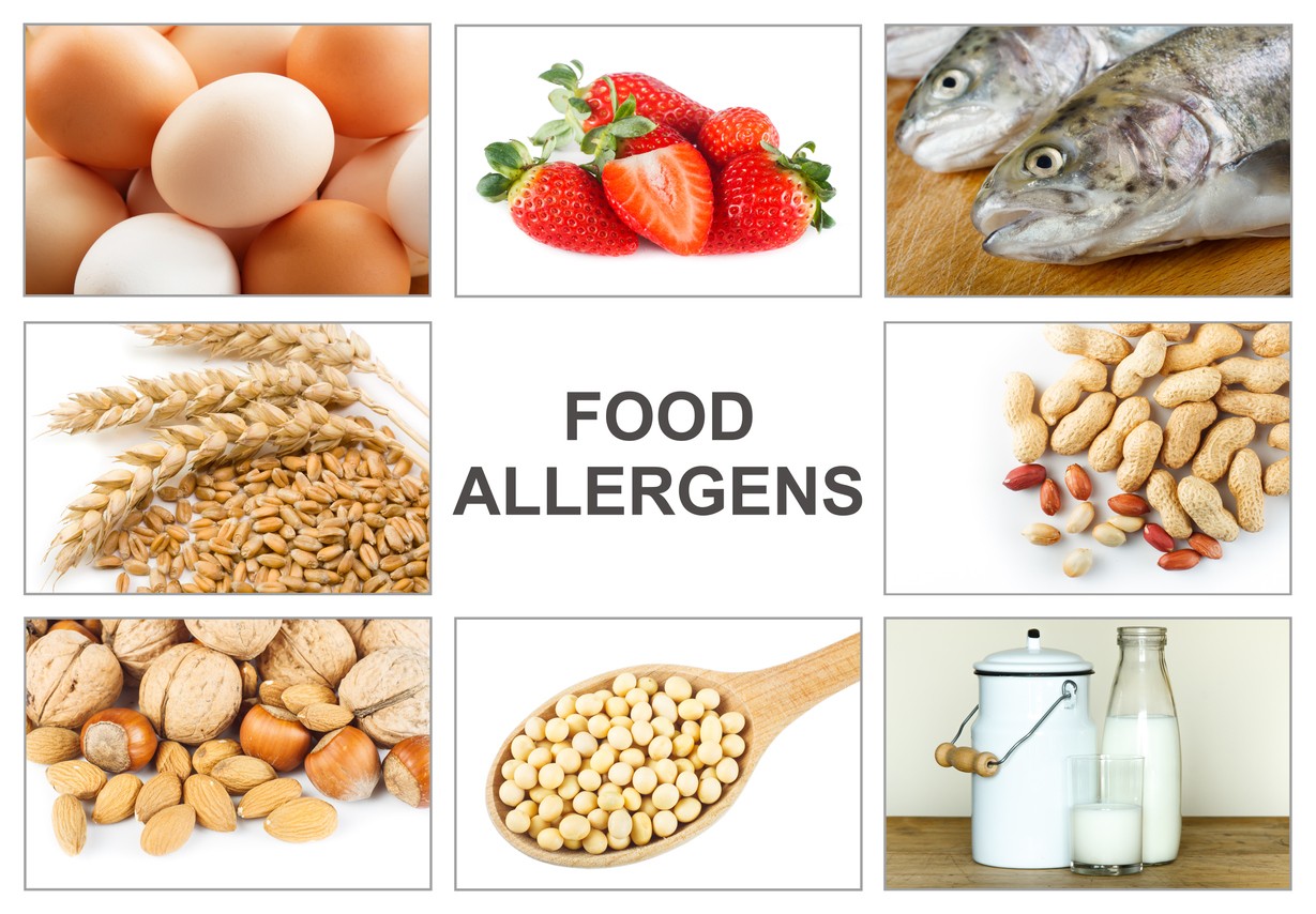 Allergie alimentari