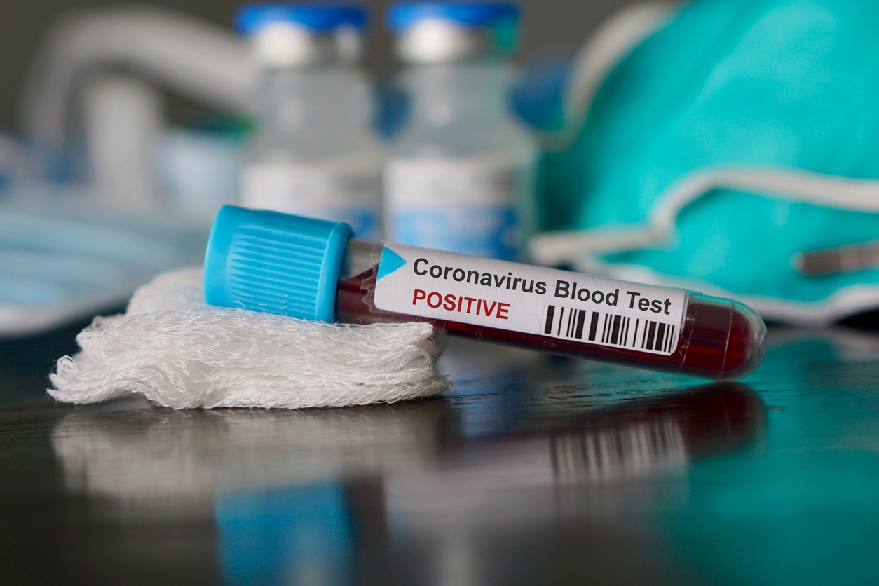 Coronavirus