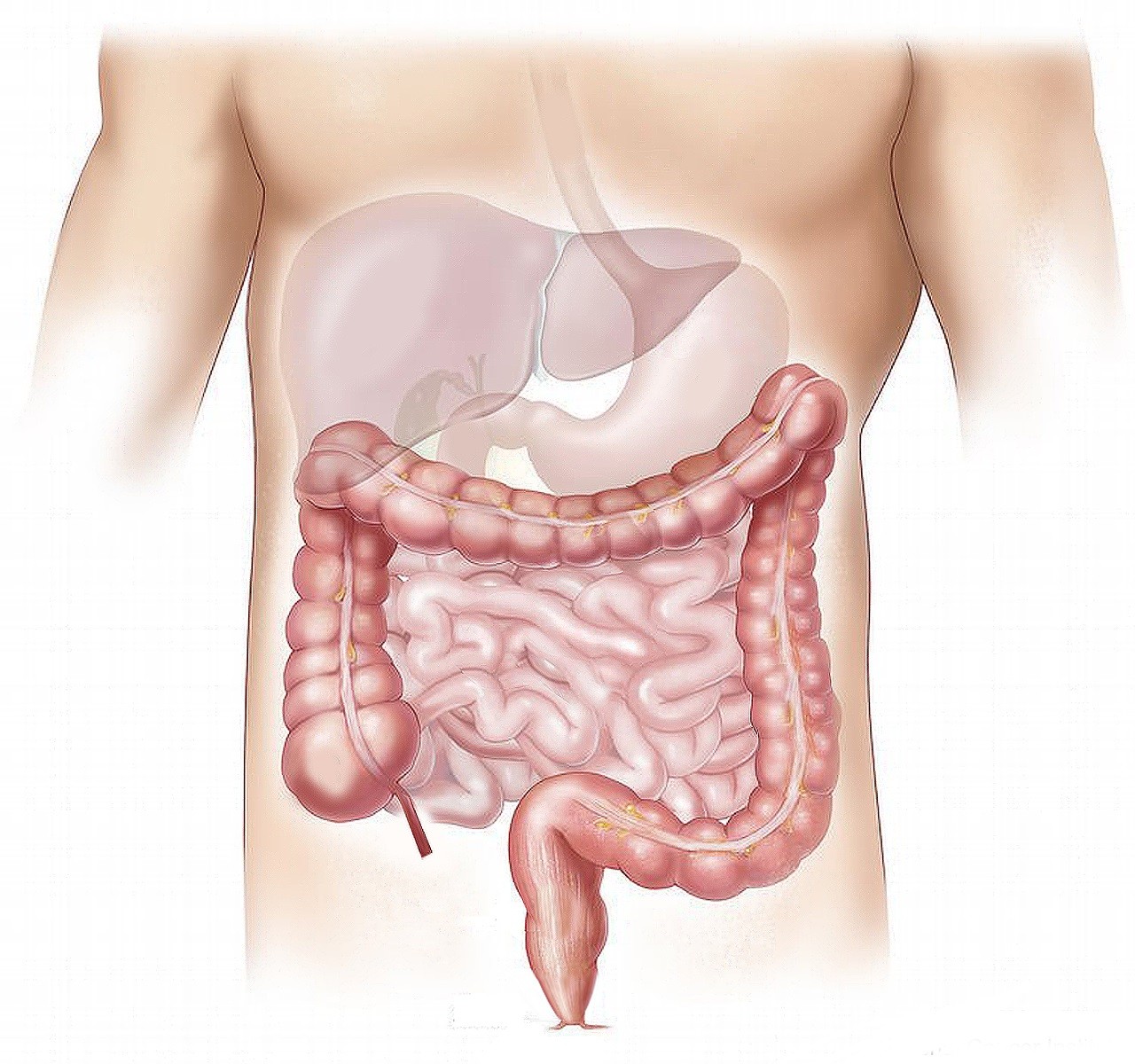 Screening per il tumore colon