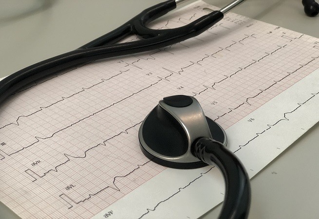 Sindrome di Brugada, elettrocardiogramma